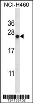 BAG2 Antibody (C-term)