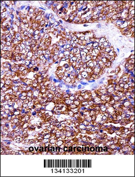 BAG2 Antibody (C-term)
