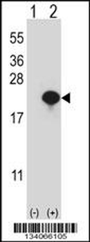 CYB5A Antibody (Center)