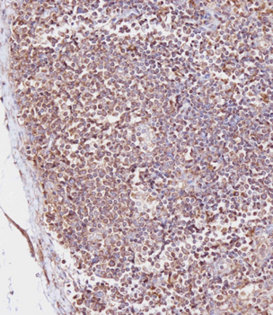 CD163L1 Antibody (C-term)