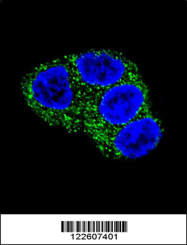 UGT1A1 Antibody (N-term)