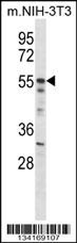 Mouse Akt2 Antibody (N-term)