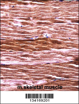 Mouse Akt2 Antibody (N-term)