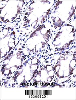 HRASLS5 Antibody (Center)