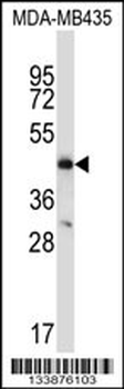 CCR9 Antibody (C-term)