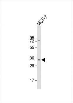 CASP6 Antibody (N-term)