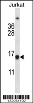 BCL2 Antibody (Center)