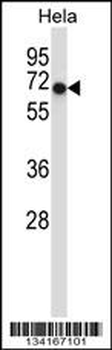 Mouse Acvr1 Antibody (Center)