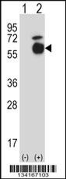 Mouse Acvr1 Antibody (Center)