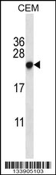 CBX5 Antibody (Center)