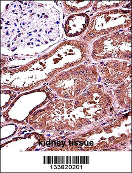 RANBP3L Antibody (Center)