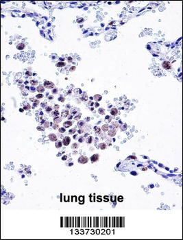 ARHGDIB Antibody (C-term)