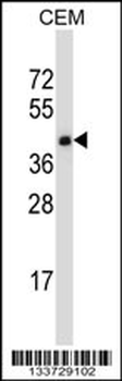 TNFRSF10D Antibody (C-term)