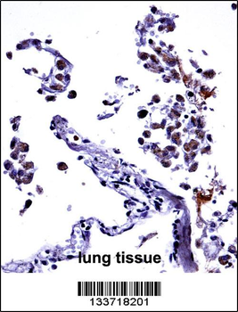 IL13 Antibody (C-term)