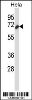 CTTN Antibody (Center)