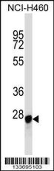 LGALS3 Antibody (C-term)