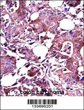 LGALS3 Antibody (C-term)