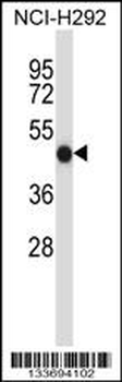 FCGR2A Antibody (C-term)