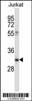 CD7 Antibody (Center)
