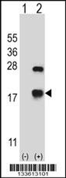 CRYAB Antibody (Center)