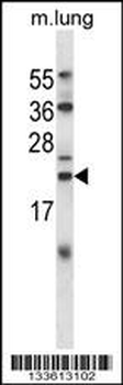 CRYAB Antibody (Center)