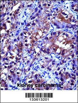 CRYAB Antibody (Center)