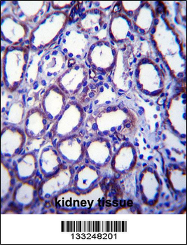 TRIM34 Antibody (N-term)