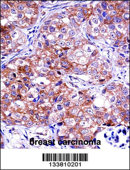 IMPDH1 Antibody (C-term)