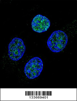 PROC Antibody (Center)