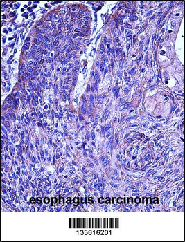 MMP3 Antibody (N-term)