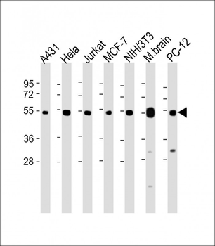 TUBA4A Antibody (C-term)