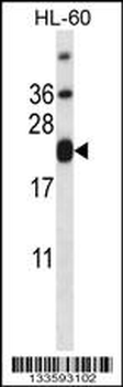 CD3E Antibody (C-term)