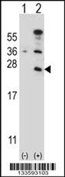 CD3E Antibody (C-term)
