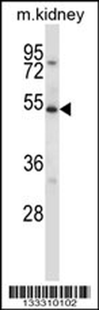ULK3 Antibody (C-term)