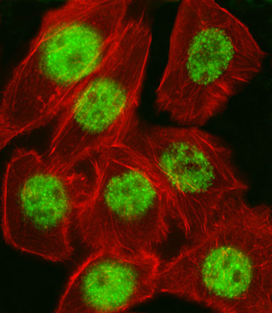 CDKN1A Antibody (C-term)