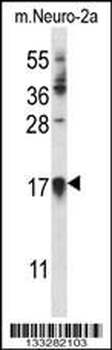 CDKN1A Antibody (C-term)