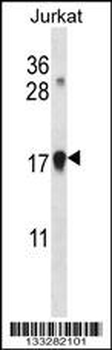 CDKN1A Antibody (C-term)