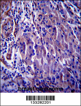 CDKN1A Antibody (C-term)