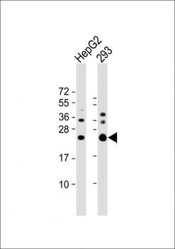 RAB5C Antibody (C-term)