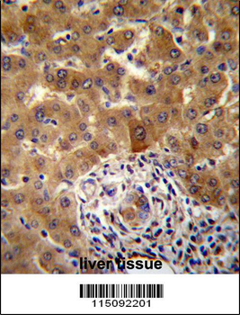 PHF17 Antibody (N-term)
