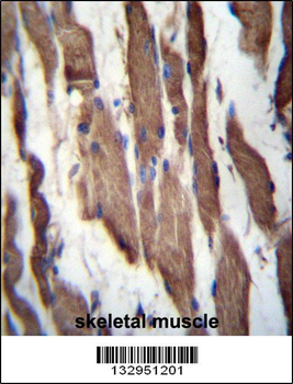 TGFBRAP1 Antibody (C-term)