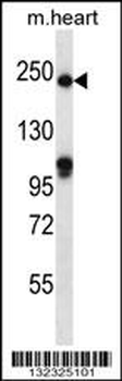 SLIT1 Antibody (N-term)