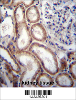 SLIT1 Antibody (N-term)