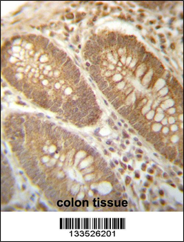 PGAM4 Antibody (N-term)
