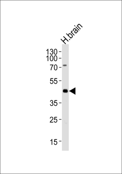 ELAVL3 Antibody (N-term)