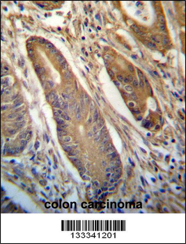 NETO2 Antibody (N-term )