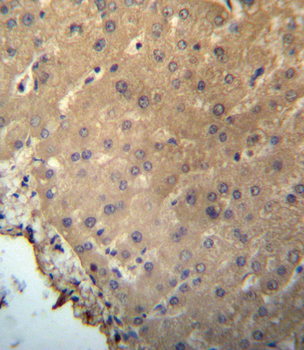 CHMP2B Antibody (N-term)