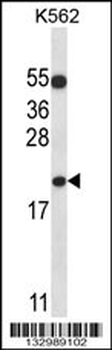 BAX Antibody (N-term)