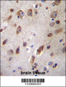 B3GNT1 Antibody (C-term)