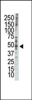 RAD9 Antibody (BH3 Domain Specific)